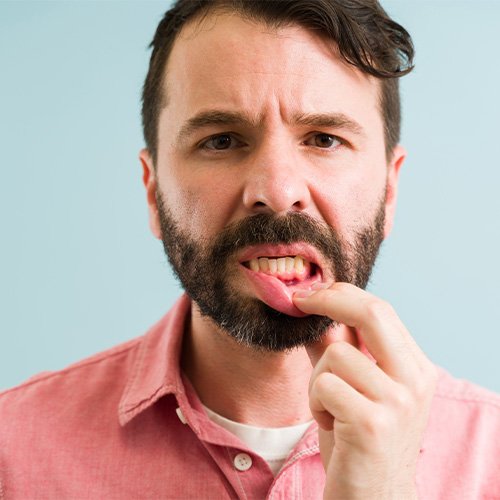 man pointing to inflamed gums